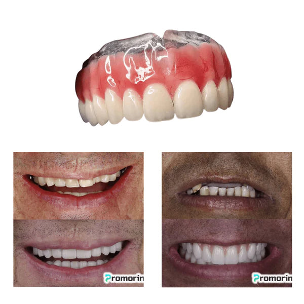 Dentadura de Silicone FIX | Ajustavel e Adaptativa Saúde & Beleza (Dentadura 1) Dm Stores 